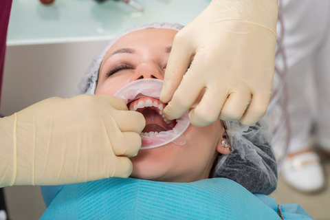 A dentist making sure the patients crowns are secured properly