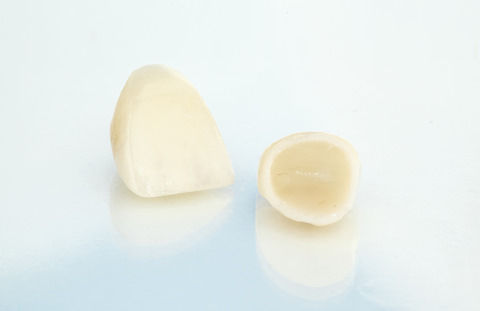 Dental crown removal