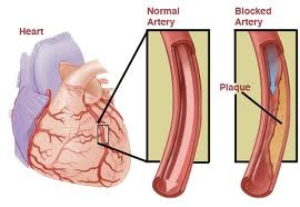 Artery diagram