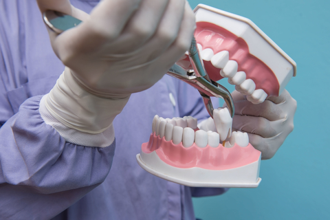 Using a mouth model a dentist acts to removing a tooth 