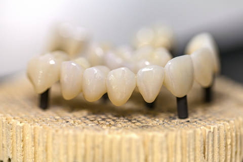 A dental bridge