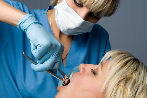 A dentist carefully extracting a lady's tooth