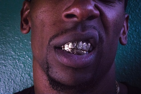 Gold teeth