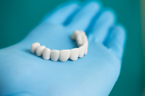 A dental bridge on a dentists hand