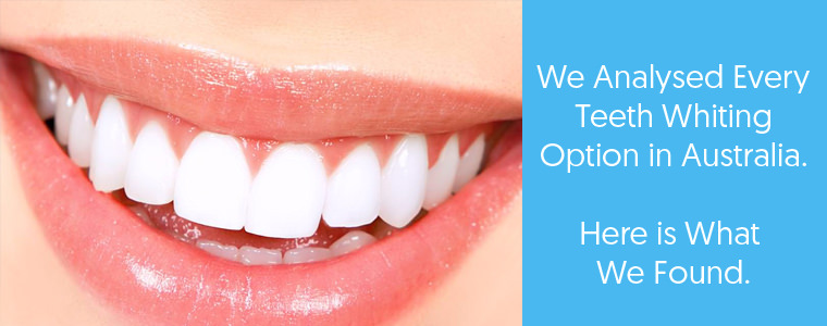 Teeth Whitening feature image with text