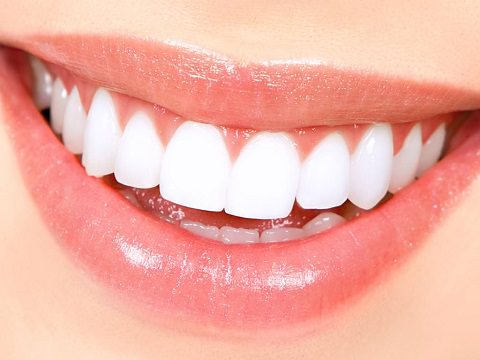 A lady smiling who has had teeth whitening