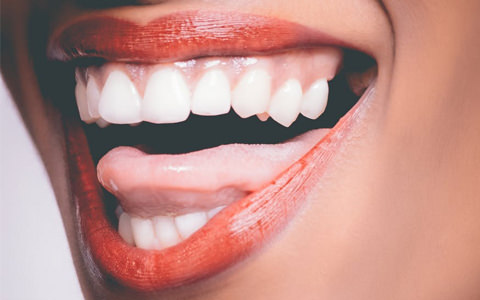 A lady smiling with great teeth and gums