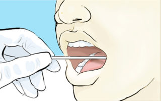 Saliva screening test