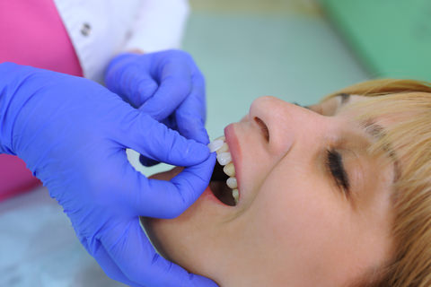 A lady getting veneers put on by her dentist