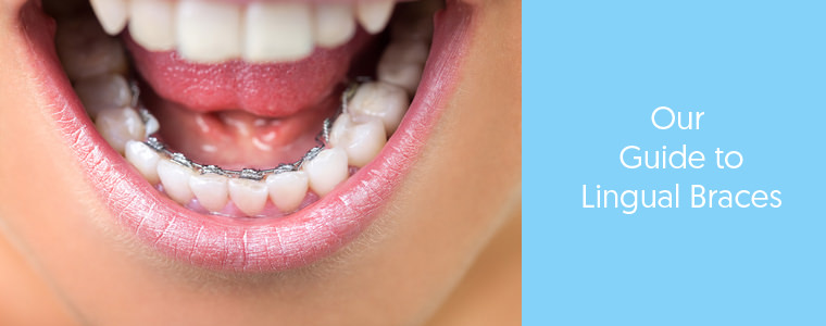 Orthodontics Australia  Your Guide to Lingual Braces [Including