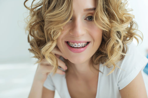 A lady with metal braces helping to fix crooked teeth