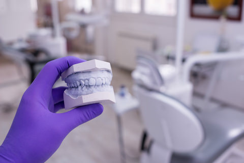 A model of a patients teeth