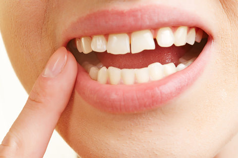 Grinding can cause pain around your teeth and gums
