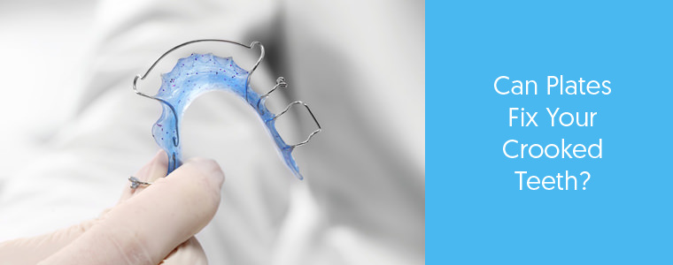 Fixing Crooked Teeth with Plates Feature image Dental Aware