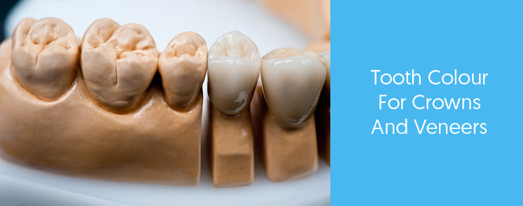 Tooth Colour for Crowns and Veneers - Dental Aware feature image