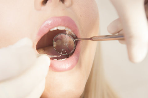 A patient having a dental checkup