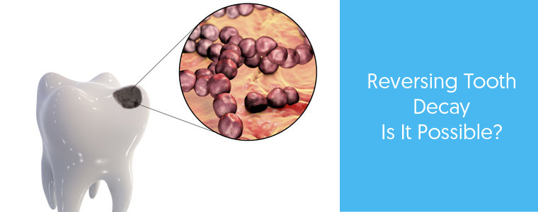 Reversing Tooth Decay