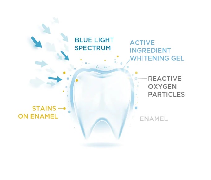Illustration of the blue LED light process by white glo
