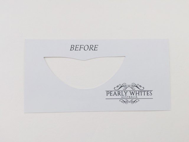 "Before" pearly whites teeth shade card