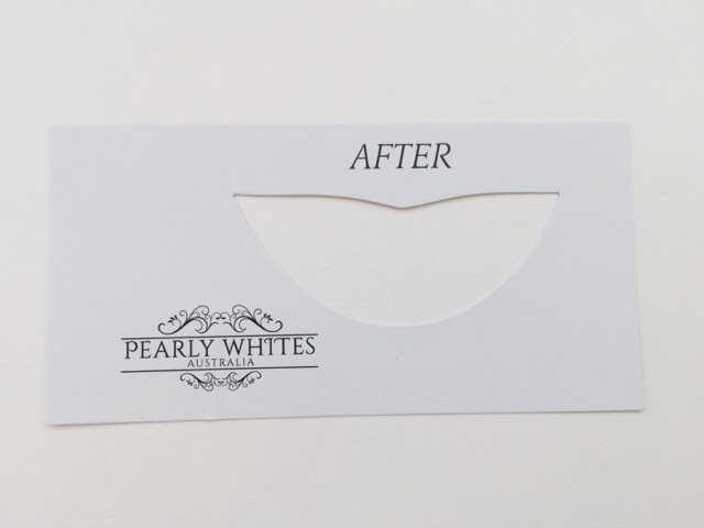 The Pearly Whites "After" teeth shade cutout