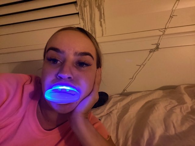 lulu testing the Advance whitening kit