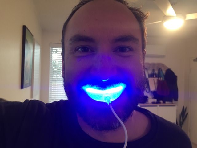 Testing the Snow Teeth Whitening system