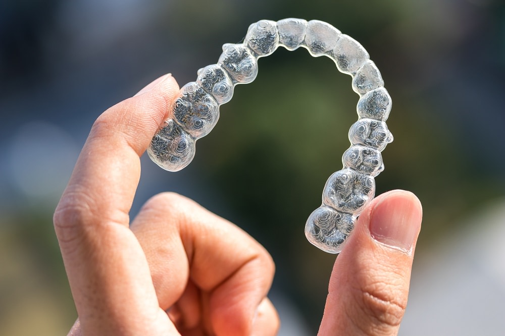 A person holding a dental aligner