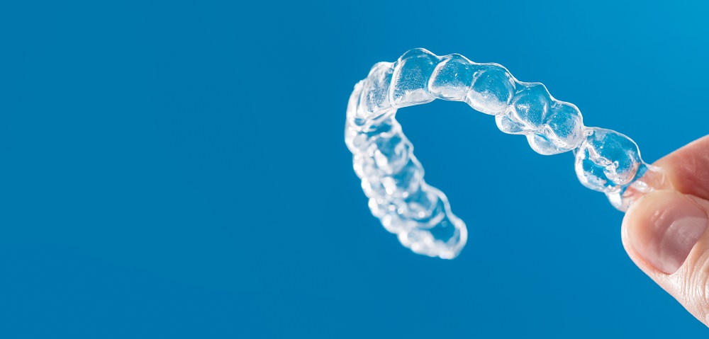 Dental Aligner costs Dental Aware feature image