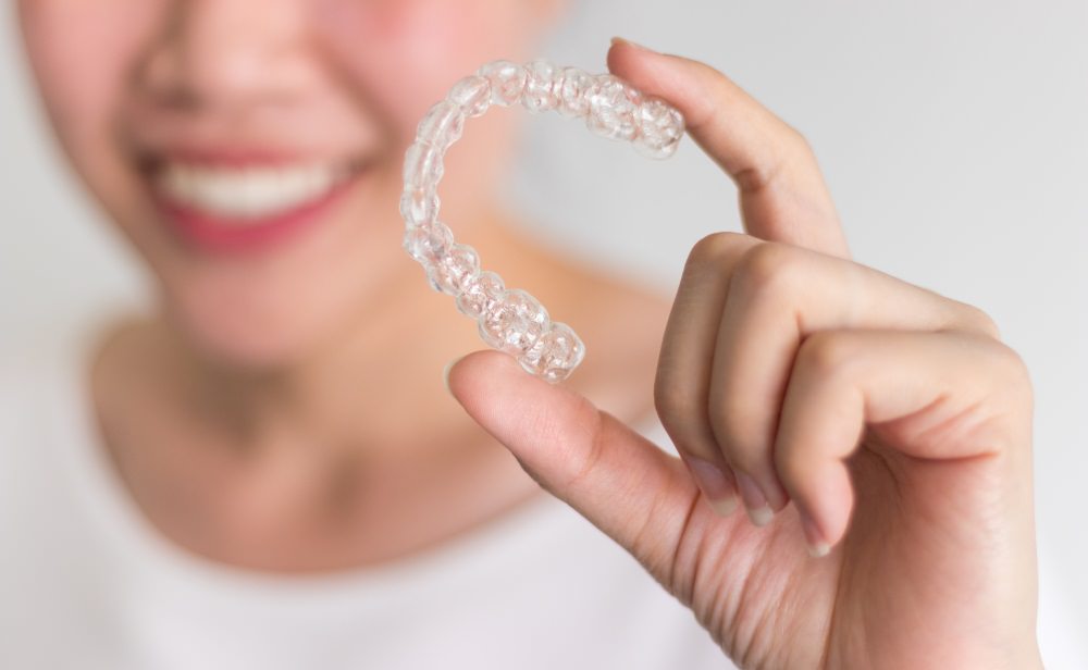 Invisalign clear aligner