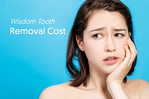 Teeth whitening adelaide cost