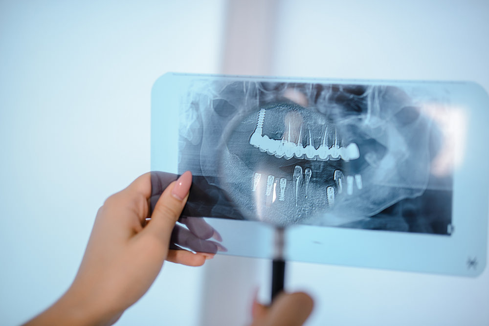 A dentist reviewing a Orthopantomogram or OPG