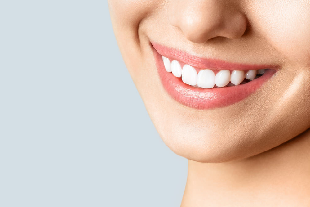 Dental costs teeth whitening feature image dental aware