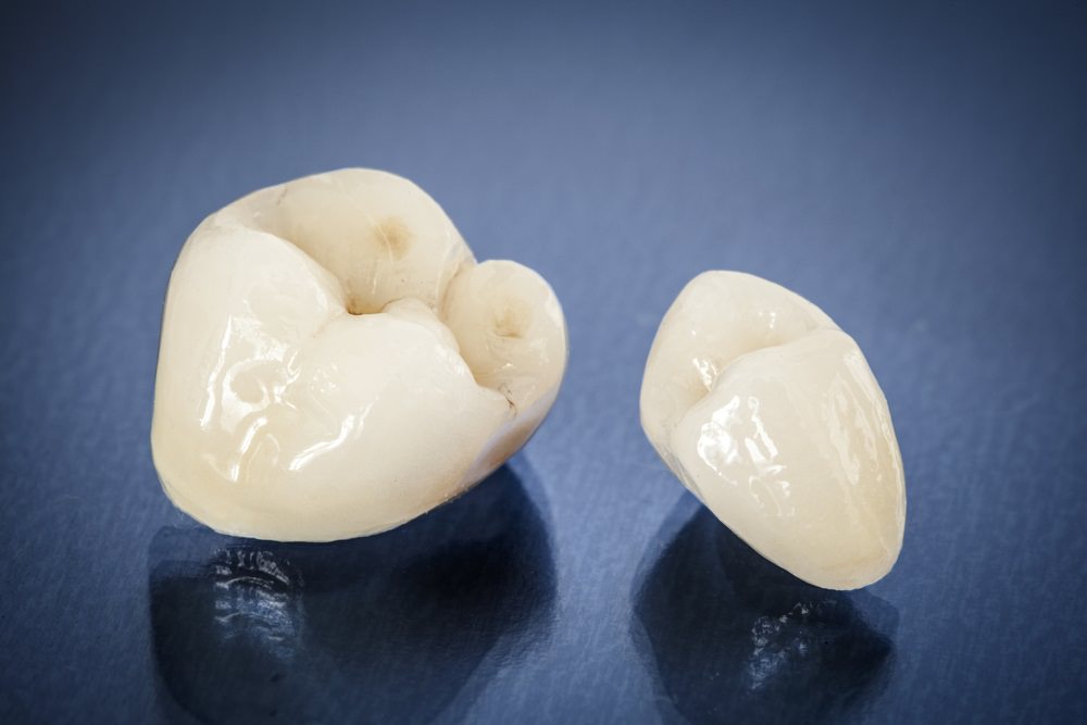 Ceramic crowns