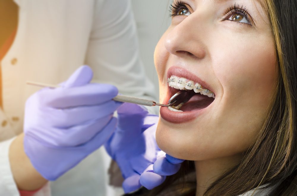 A woman having a checkup of her braces