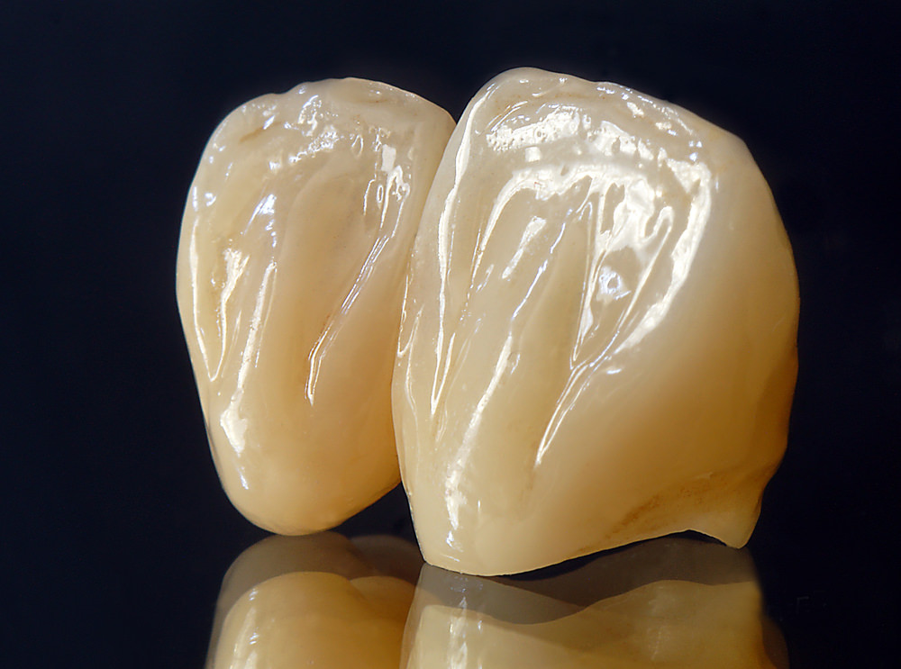 Ceramic zirconia crowns