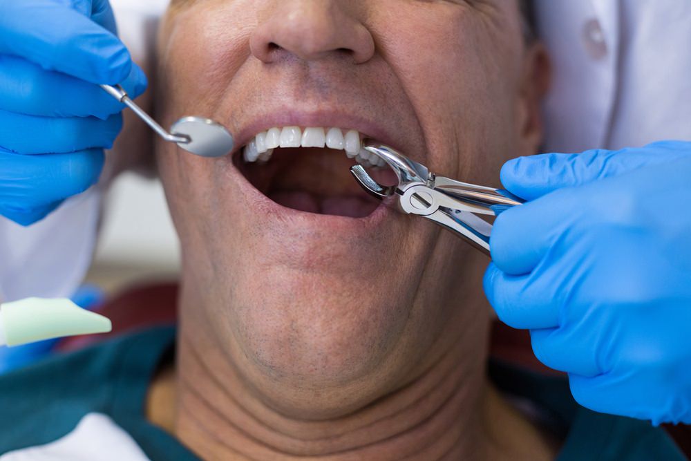 a dentist extracting a tooth