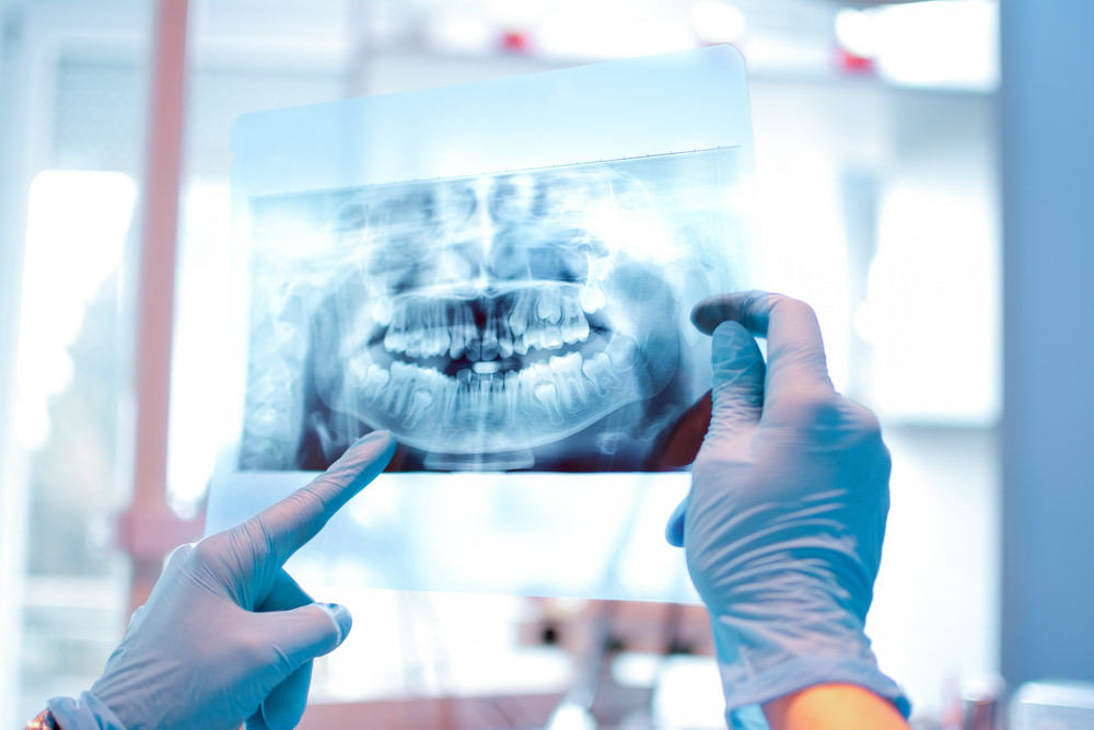 Dental x-ray costs dental aware