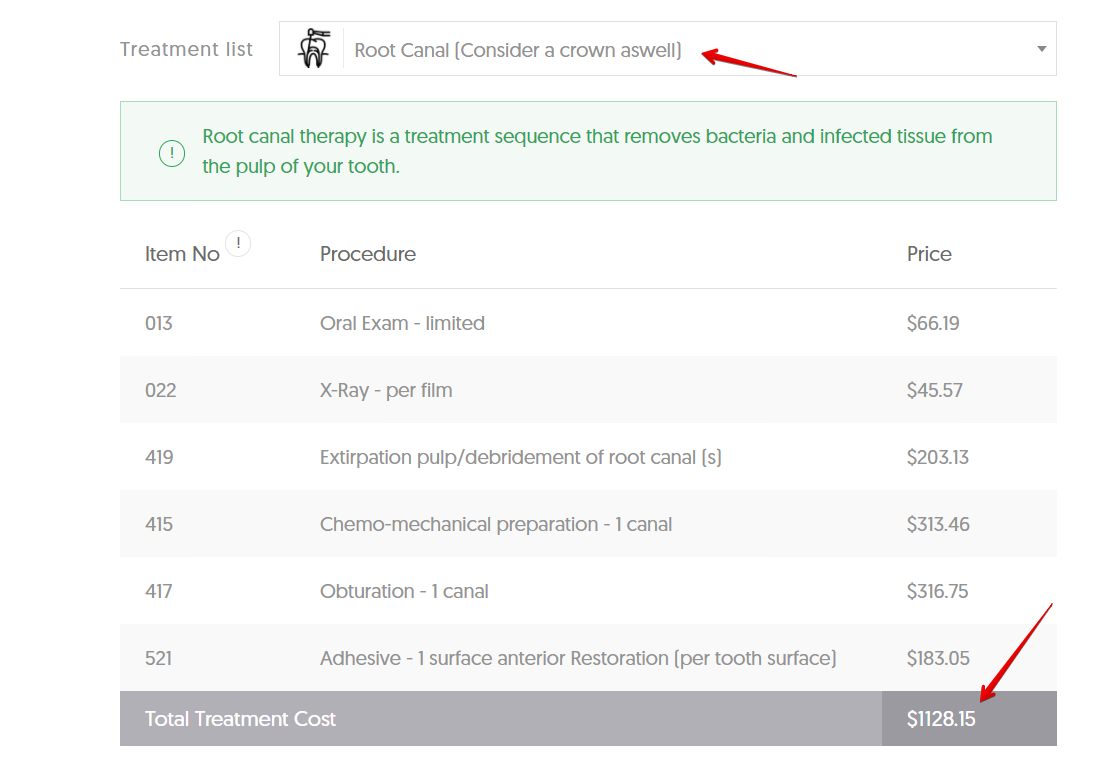 The average cost of a root canal in the ACT