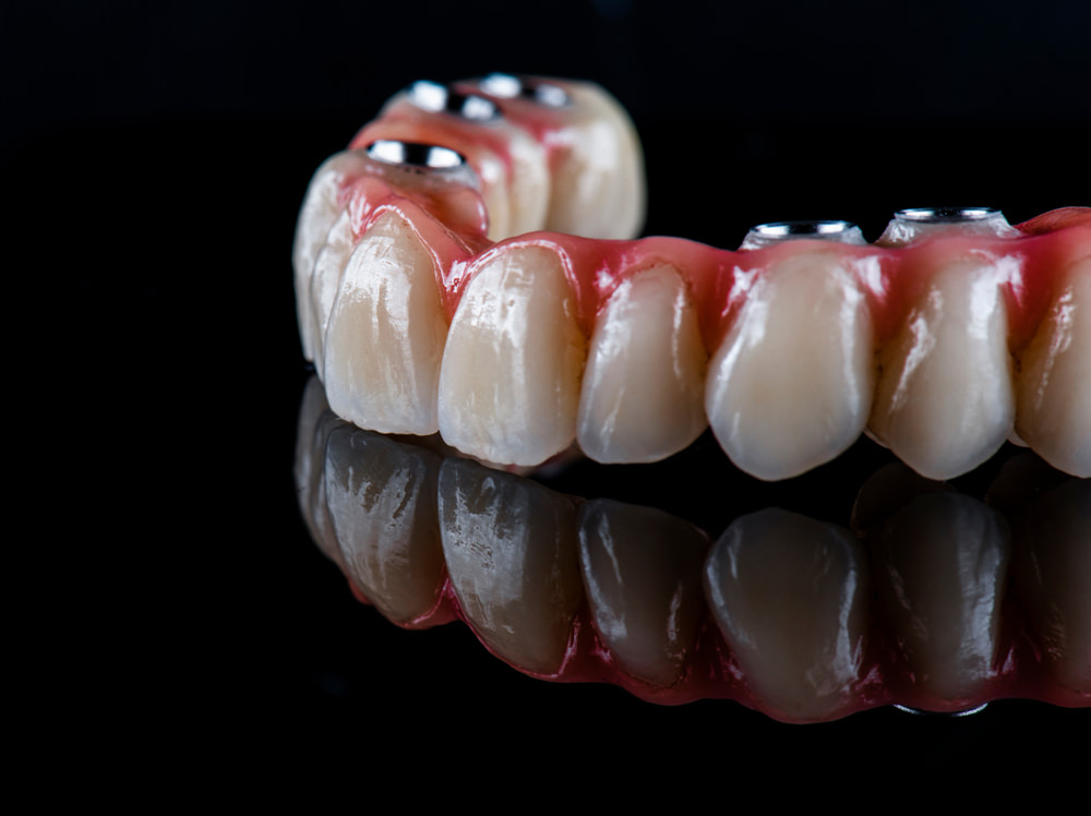 a dental bridge on a black background