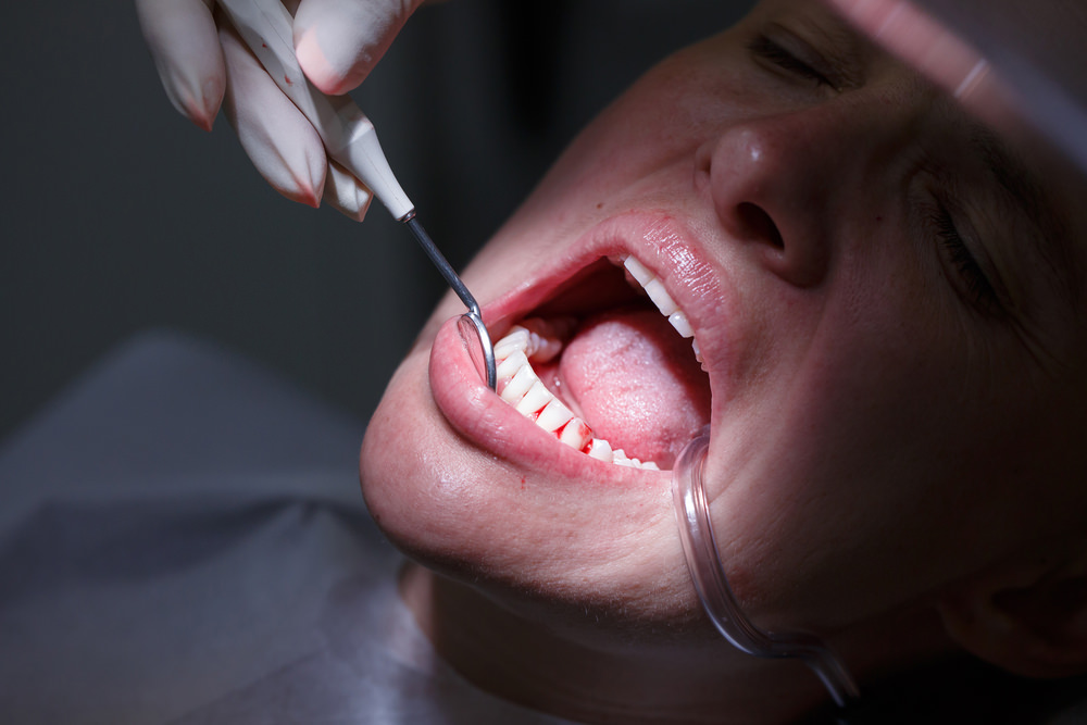A patient seeing a periodontist