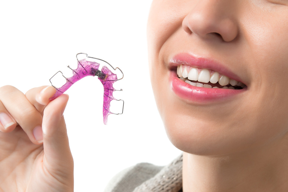 A lady holding a dental retainer in her fingers