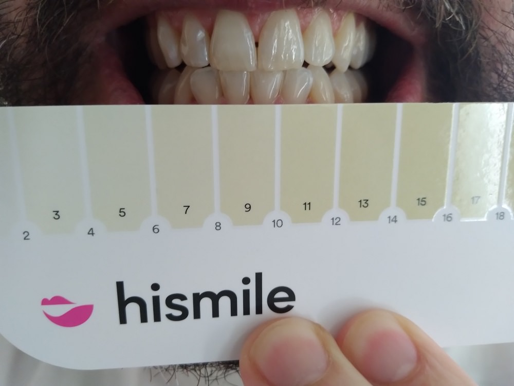 HiSmile tooth colour guide before using the PAP+ Teeth whitening kit