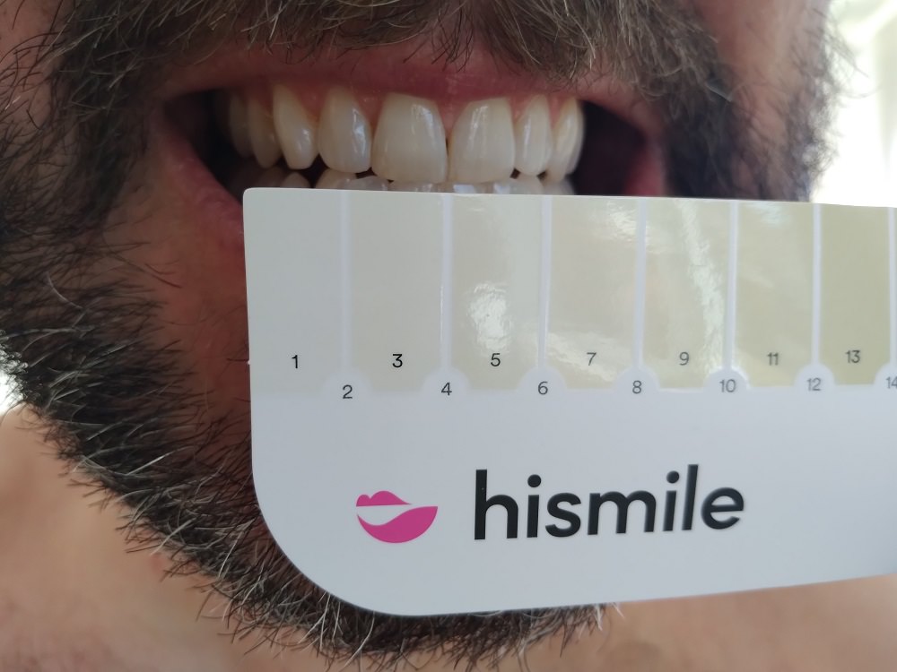 After using the HiSmile Teeth Whitening kit