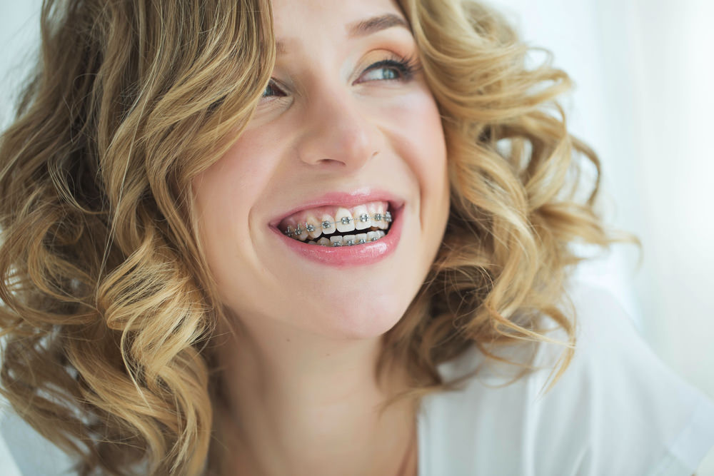 A woman with dental braces smiling.