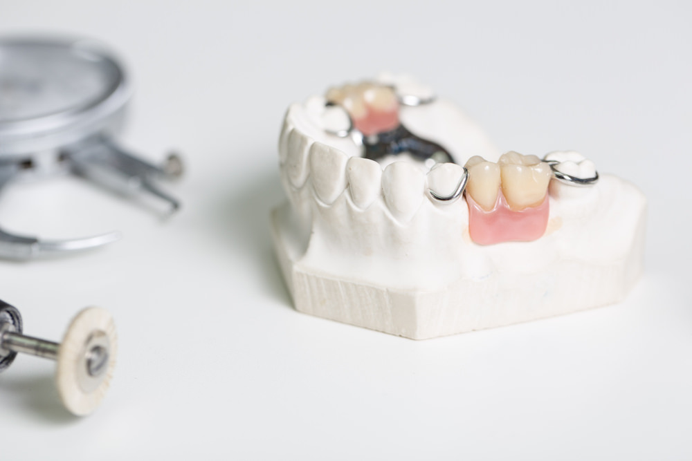 partial dentures which a prosthetist created
