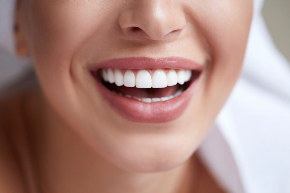fastest way to whiten your teeth dental aware feature image