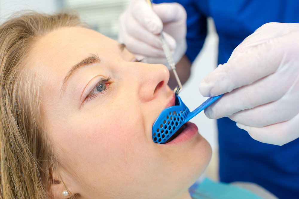 A dentist taking an impression of a womans teeth.