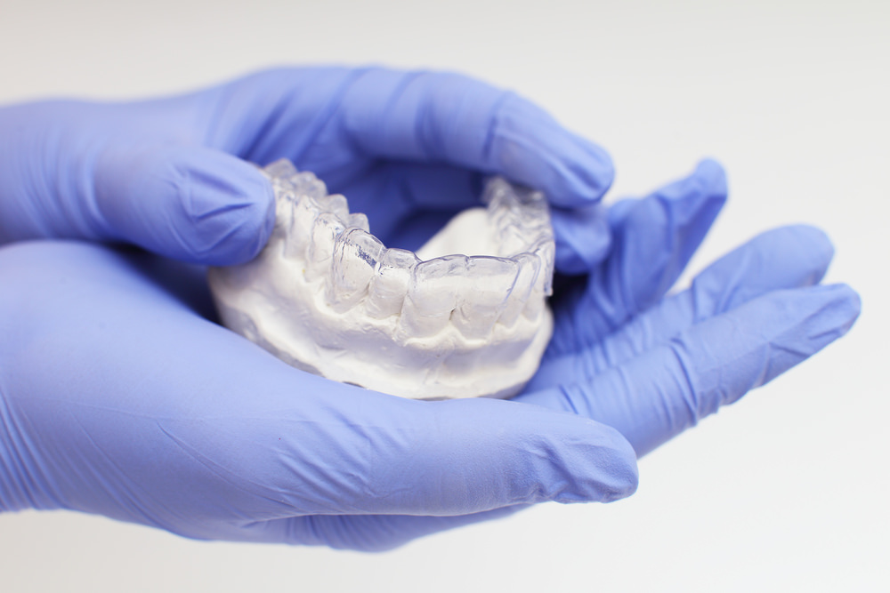 Dental mouthguard created by a dental prosthetist
