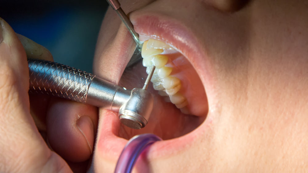 A dental drill